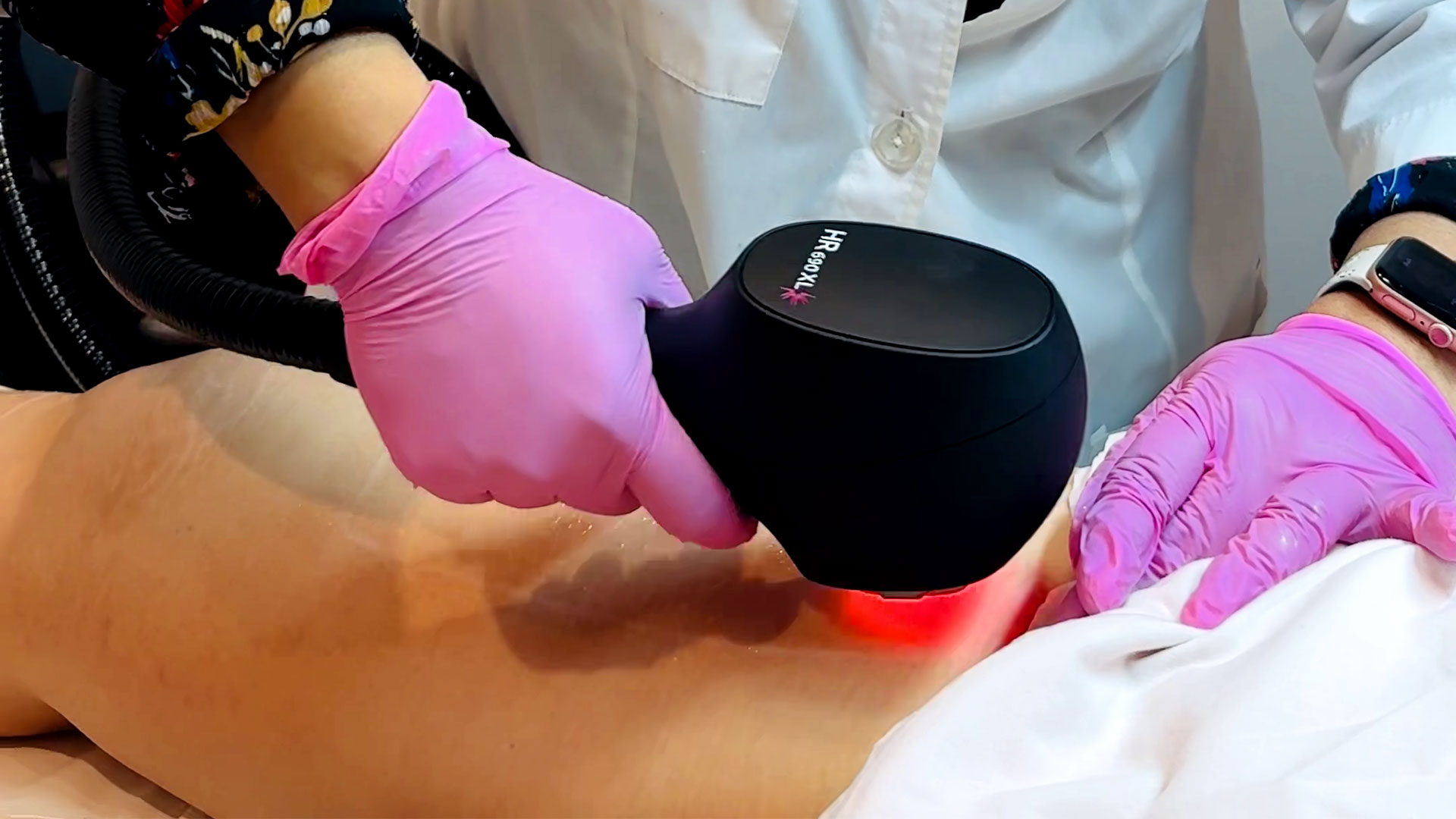 laser-Treatment-landscape (1)