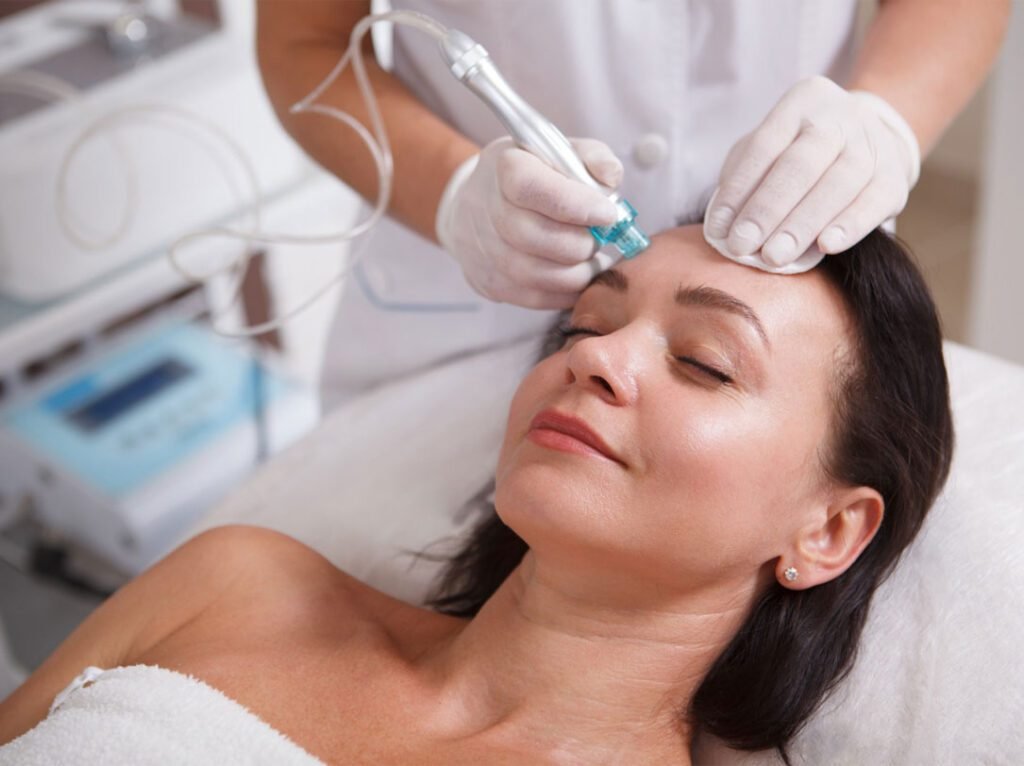 Skin resurfacing treatment on a client's forehead