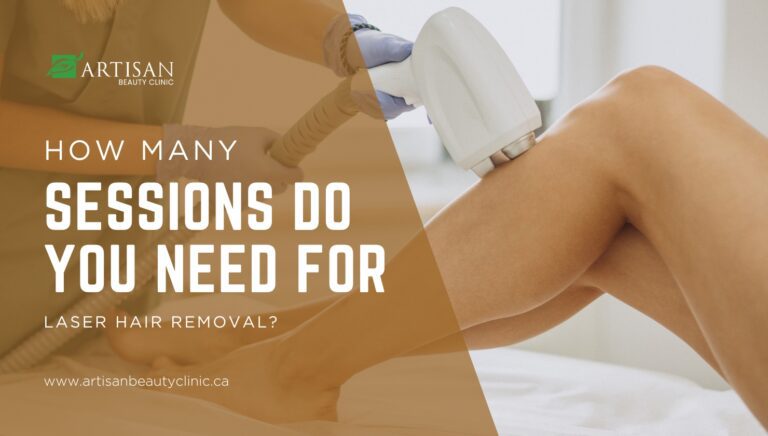 How Many Sessions Do You Need For Laser Hair Removal