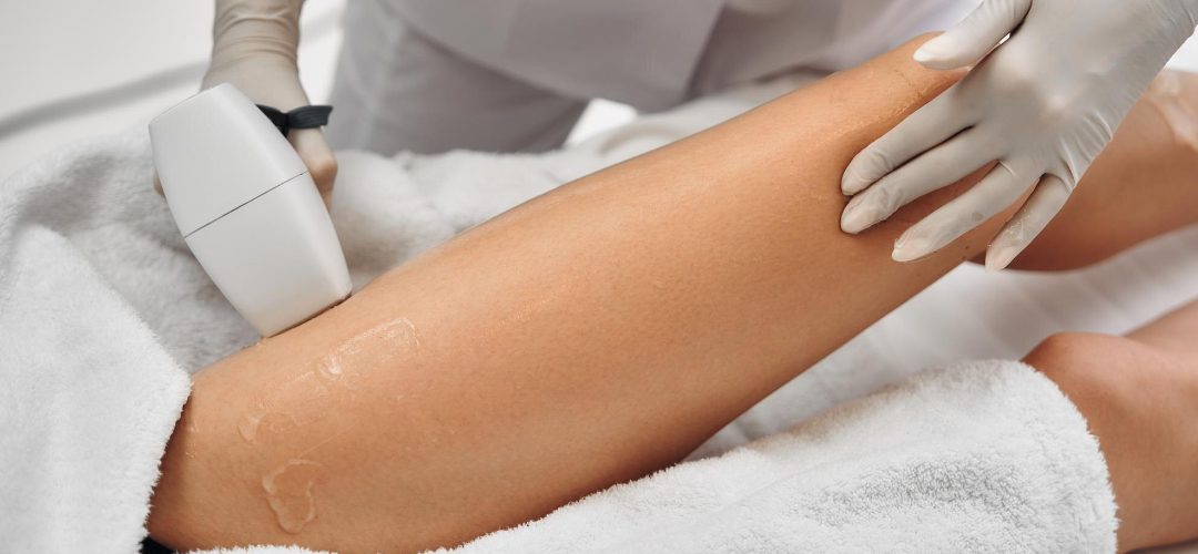 Why Our Hair Removal Treatment Is Best
