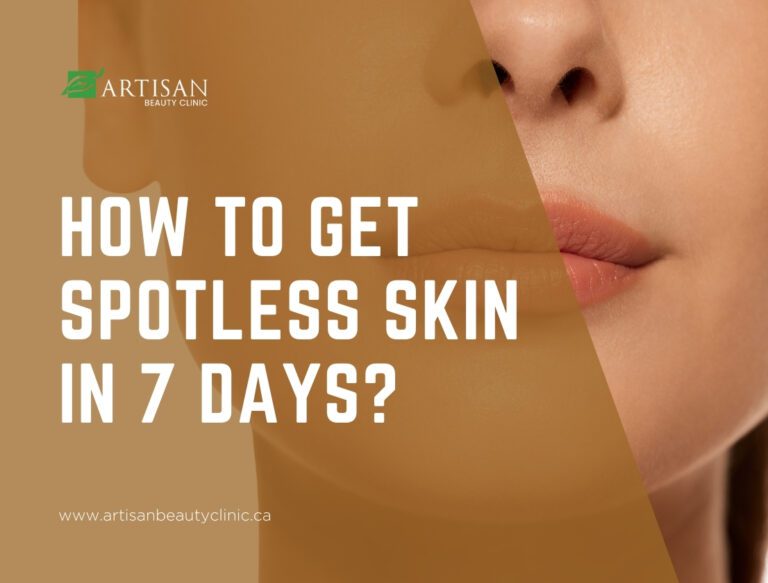 How to get spotless skin in 7 days?