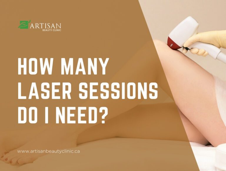How many laser sessions do I need?