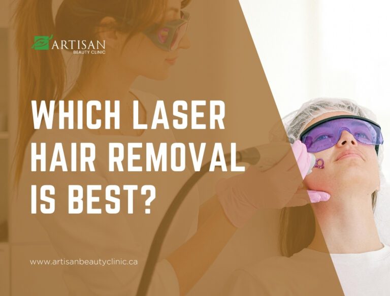 Which laser hair removal is best?