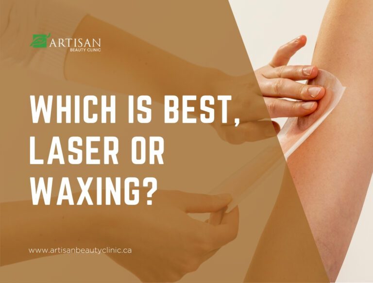 laser or waxing