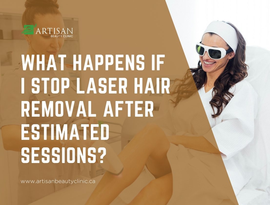 What happens if I stop laser hair removal