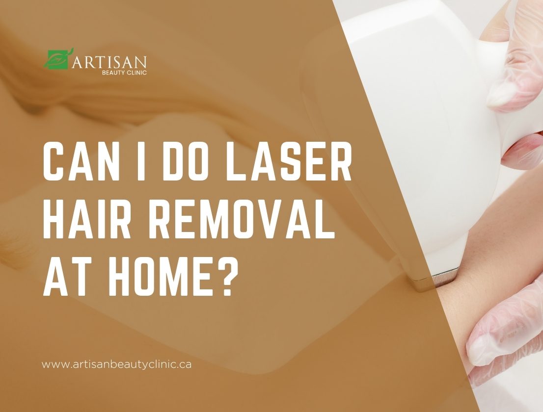 Can I do laser hair removal at home
