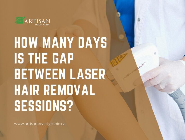 gap between laser hair removal sessions