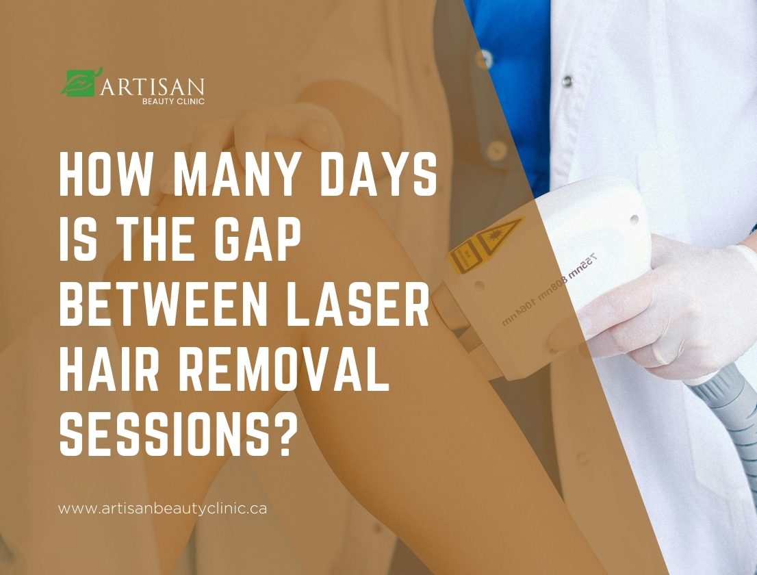 gap between laser hair removal sessions