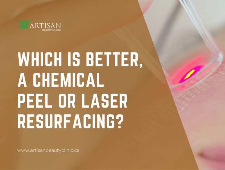 chemical peel or laser resurfacing