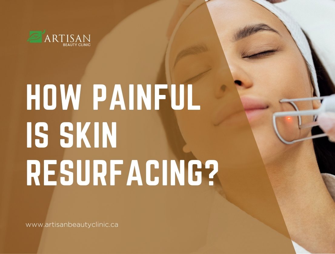 How painful is skin resurfacing?