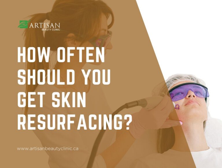 How often should you get skin resurfacing