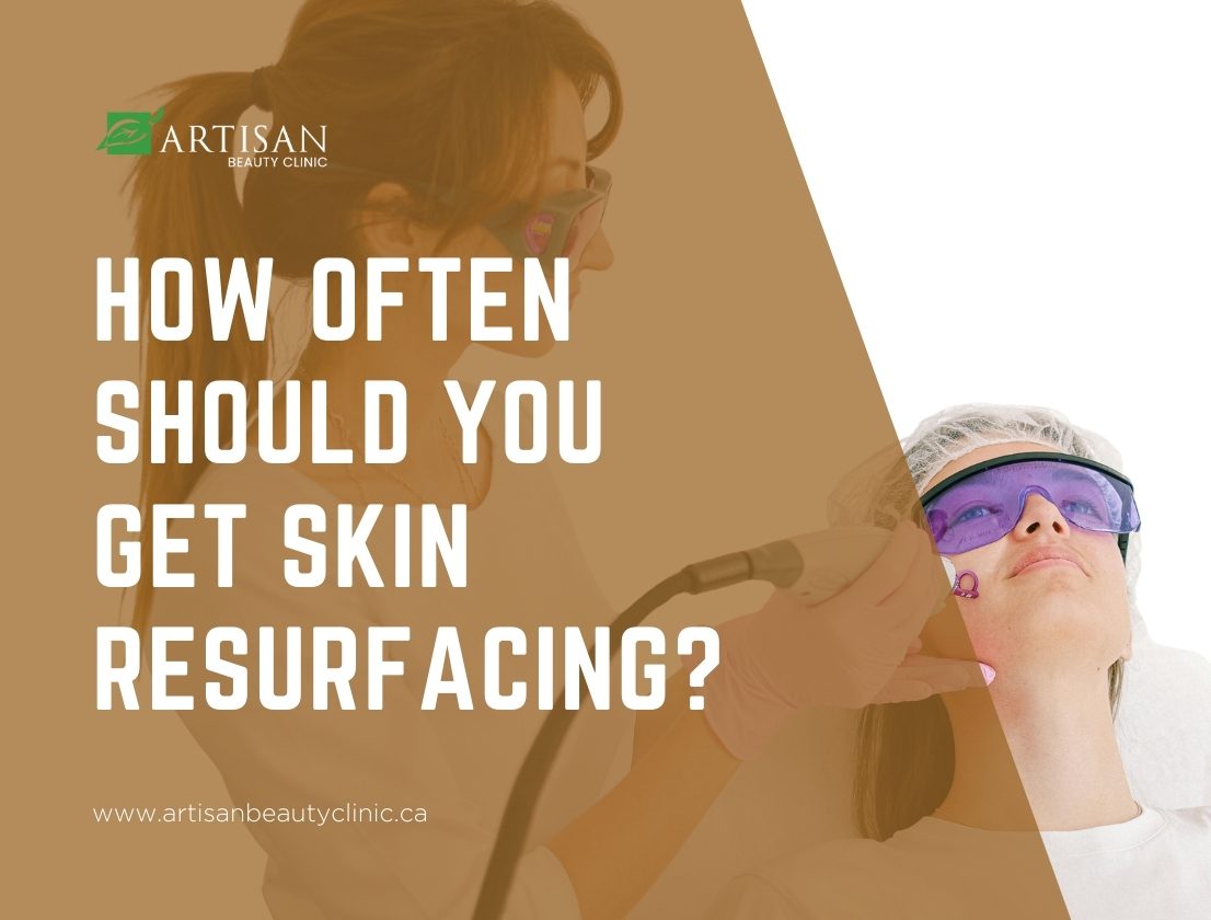 How often should you get skin resurfacing