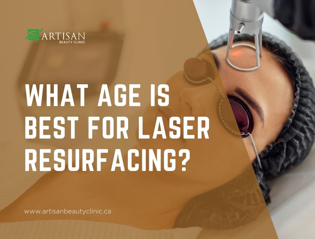 best age for laser resurfacing