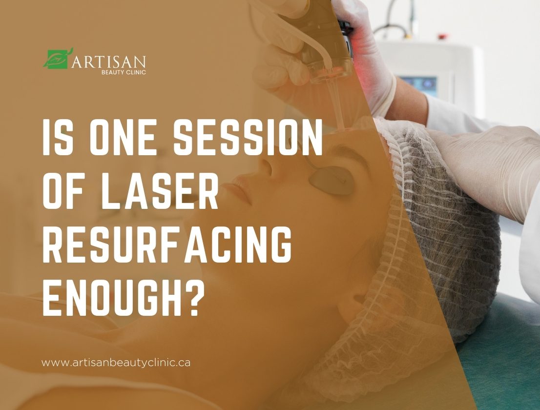 Is one session of laser resurfacing enough