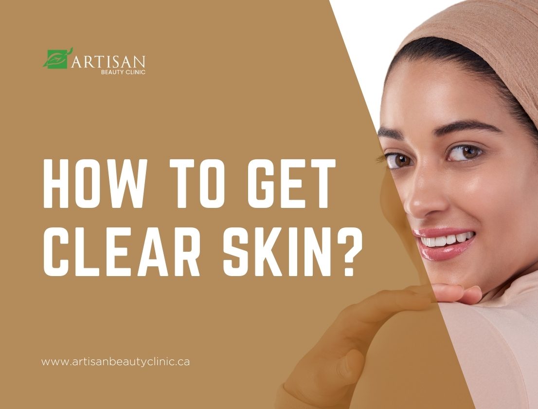 How to get clear skin?