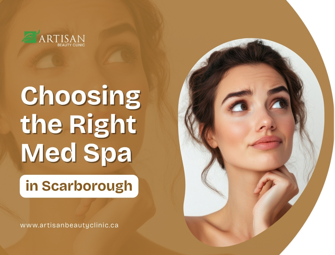 Choosing the right med spa graphic for Scarborough skincare guide.