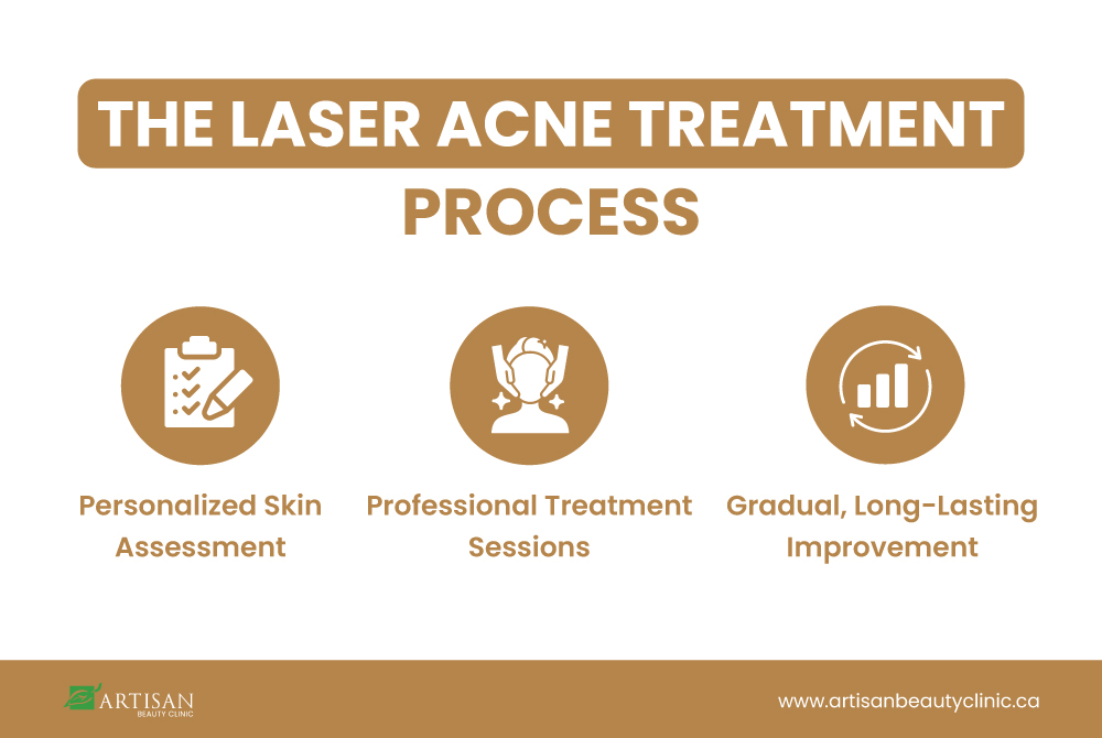 Professional performing laser acne treatment as part of a structured treatment process