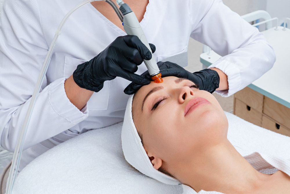 Laser skin treatment session showing targeted care for acne scar improvement