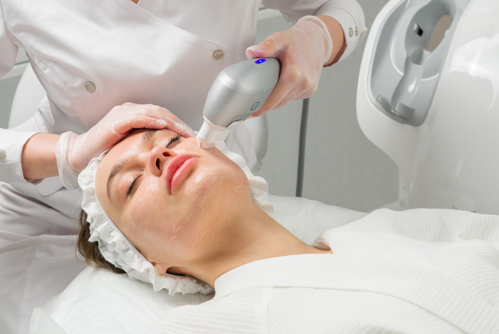 Laser treatment being performed on the face to target dark spots and pigmentation
