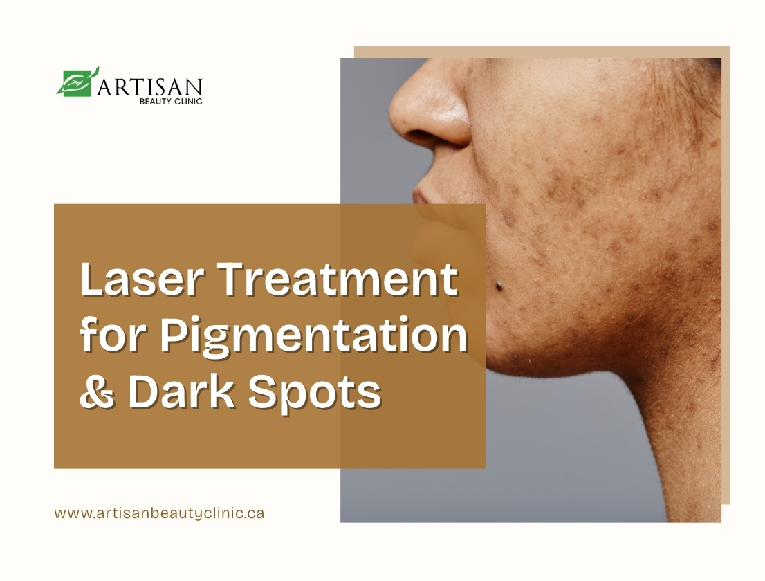 Visible pigmentation and dark spots on facial skin before laser treatment