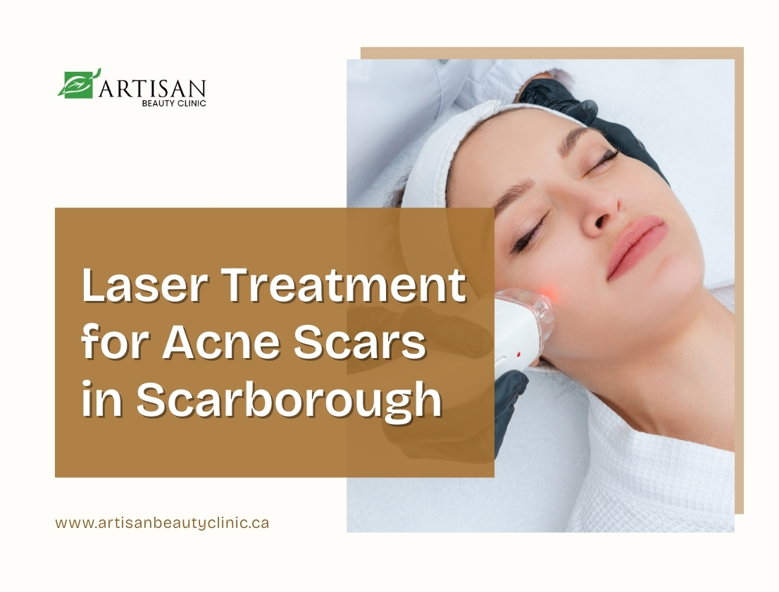 Laser treatment being performed on facial skin to reduce acne scars at a professional clinic