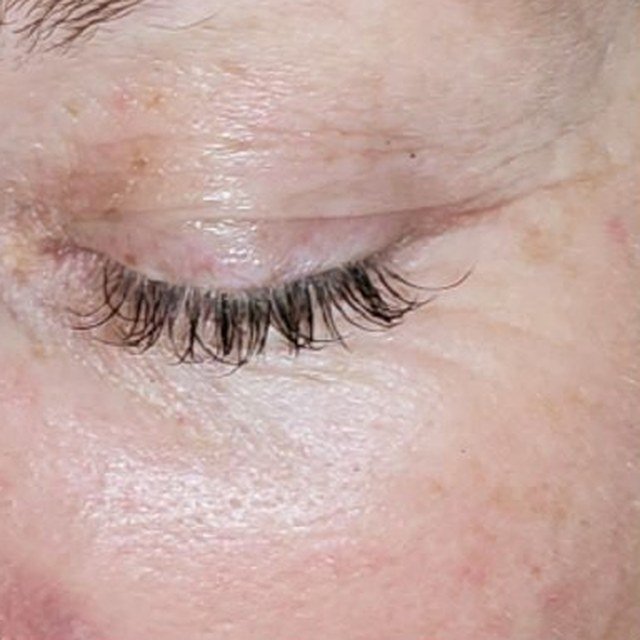 After TriBella