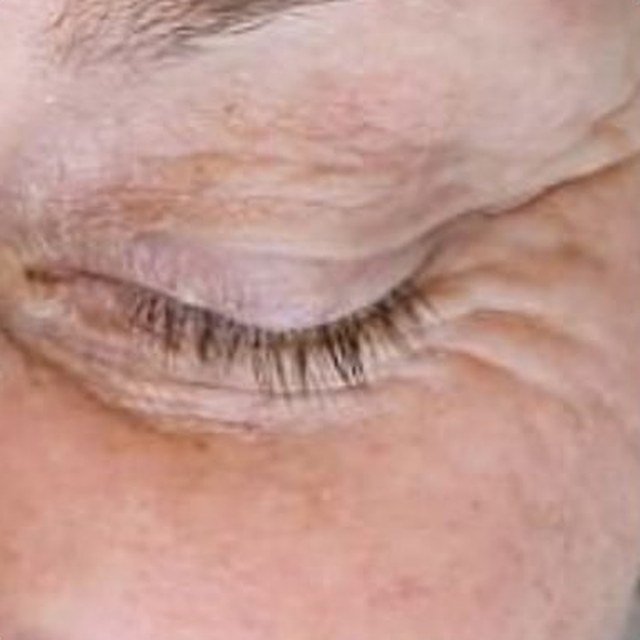 Before TriBella
