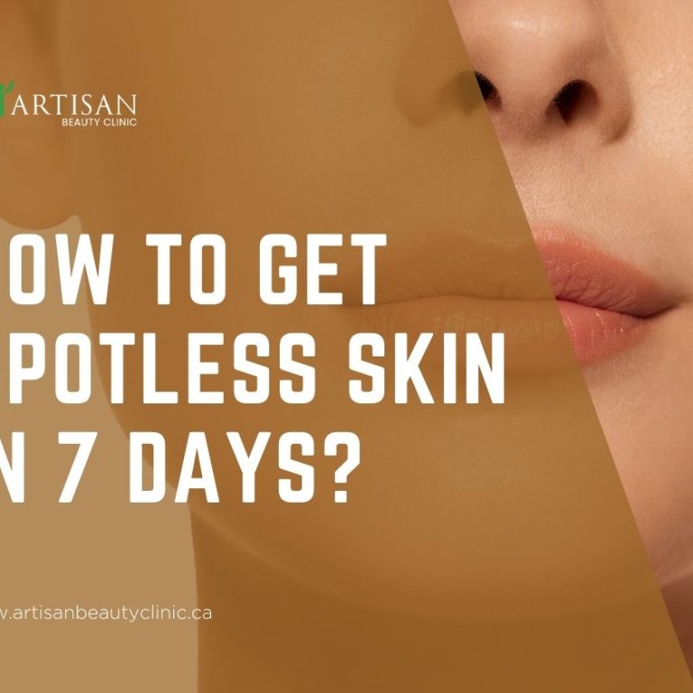 How to get spotless skin in 7 days?
