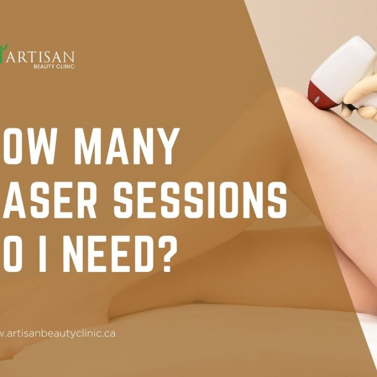 How many laser sessions do I need?
