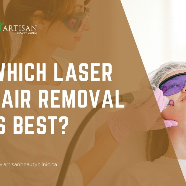 Which laser hair removal is best?