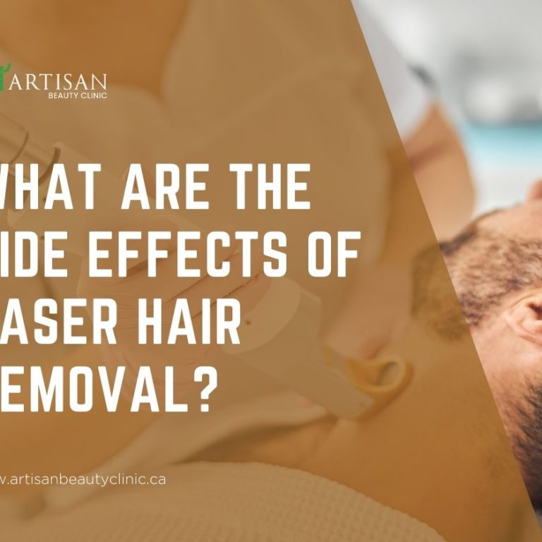 side effects of laser hair removal