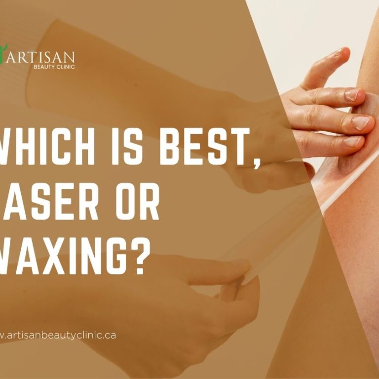 laser or waxing