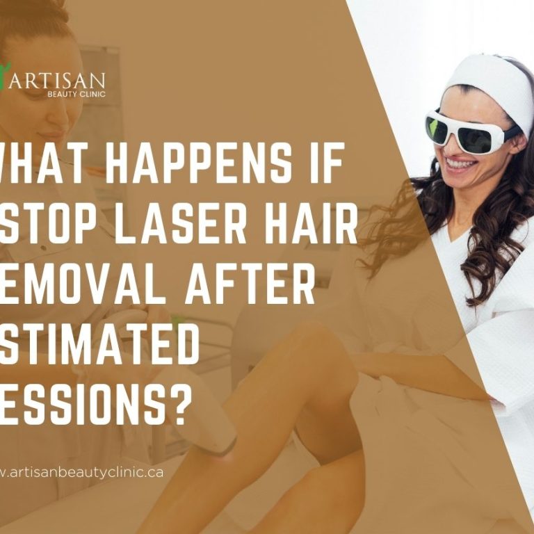 What happens if I stop laser hair removal