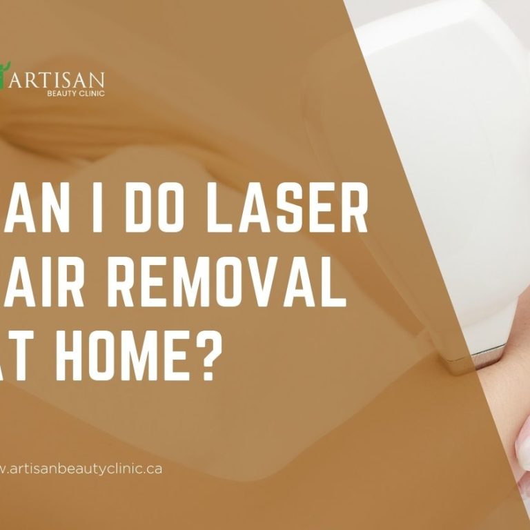 Can I do laser hair removal at home