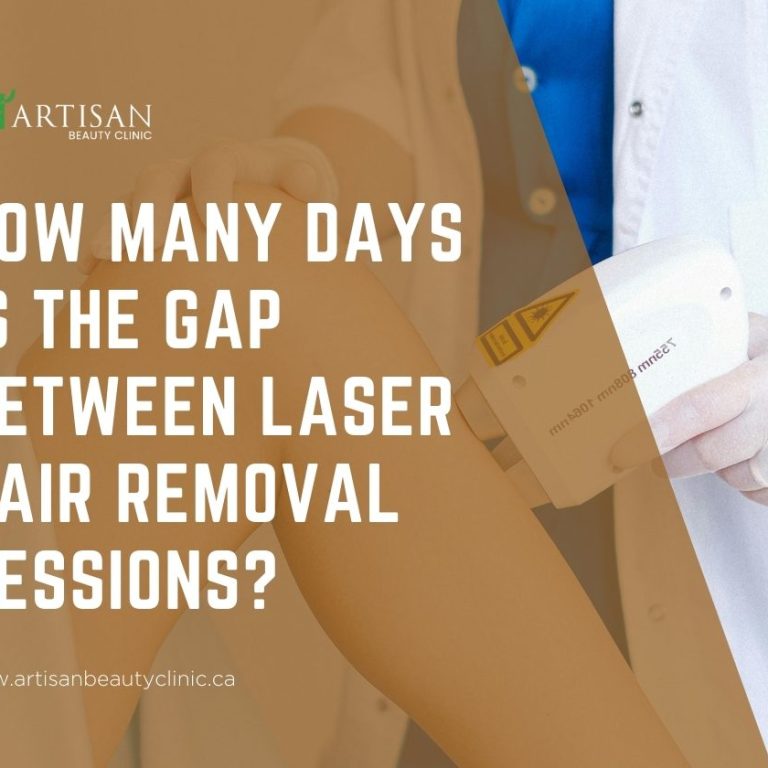 gap between laser hair removal sessions