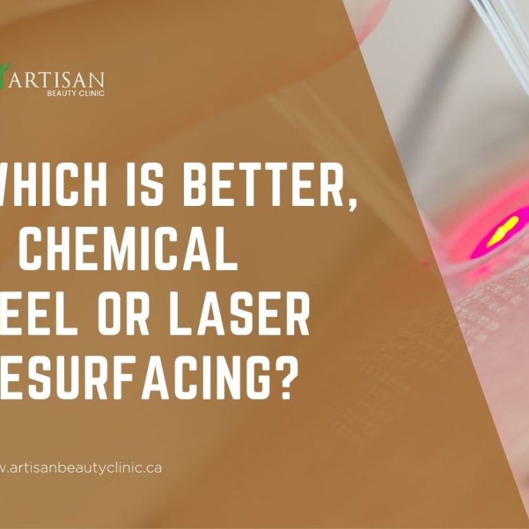 chemical peel or laser resurfacing