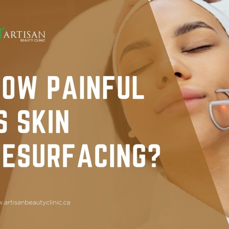 How painful is skin resurfacing?
