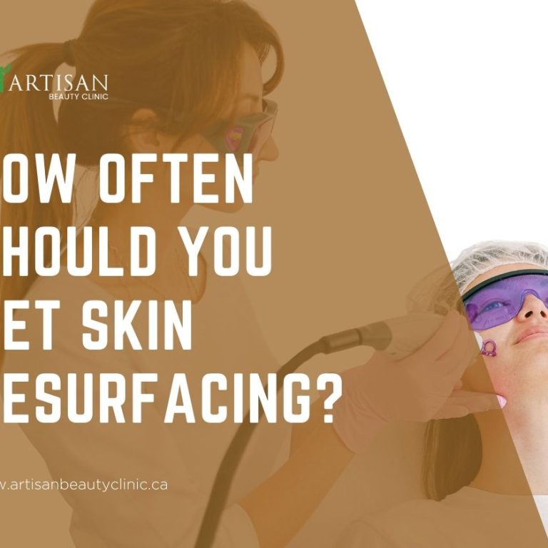 How often should you get skin resurfacing