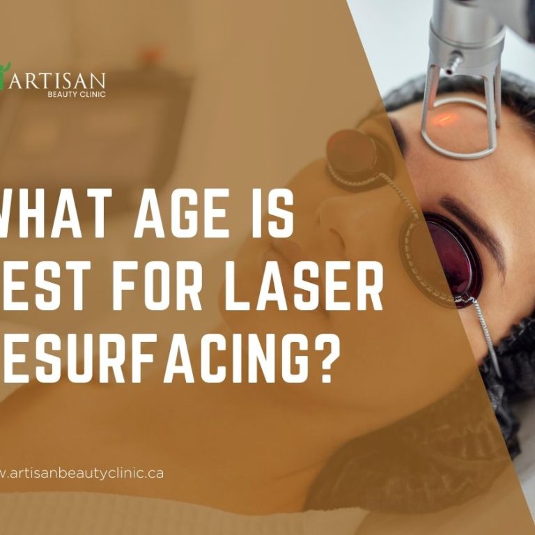 best age for laser resurfacing