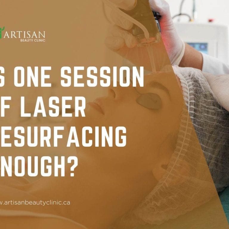 Is one session of laser resurfacing enough