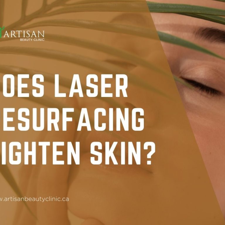 Does laser resurfacing tighten skin