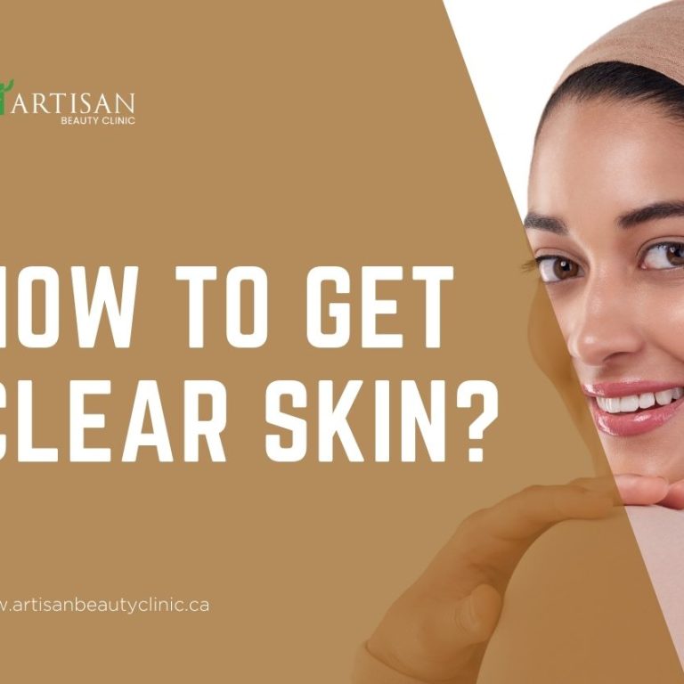 How to get clear skin?