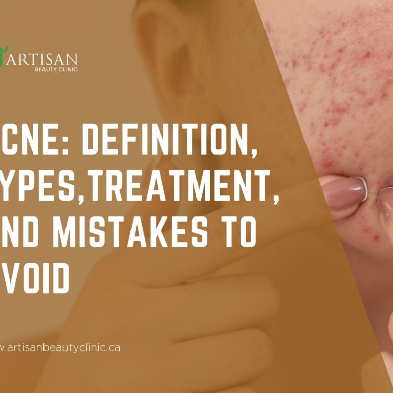 Artisan - Blog Cover